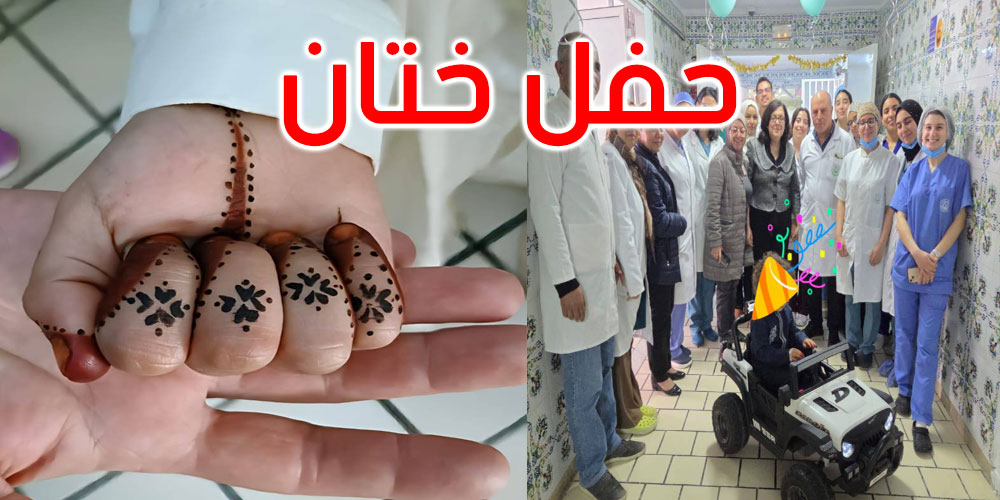 قسم جراحة الأطفال بمستشفى الحبيب ثامر يحتفي بأطفاله في حفل ختان جماعي