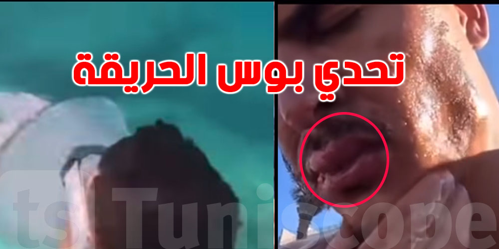 بعد فيديو تحدي بوس الحريقة :''تقبيل'' قنديل البحر قد يسبب مضاعفات قاتلة