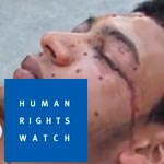 HRW : les évènements de Siliana démontrent le besoin de formation des policiers
