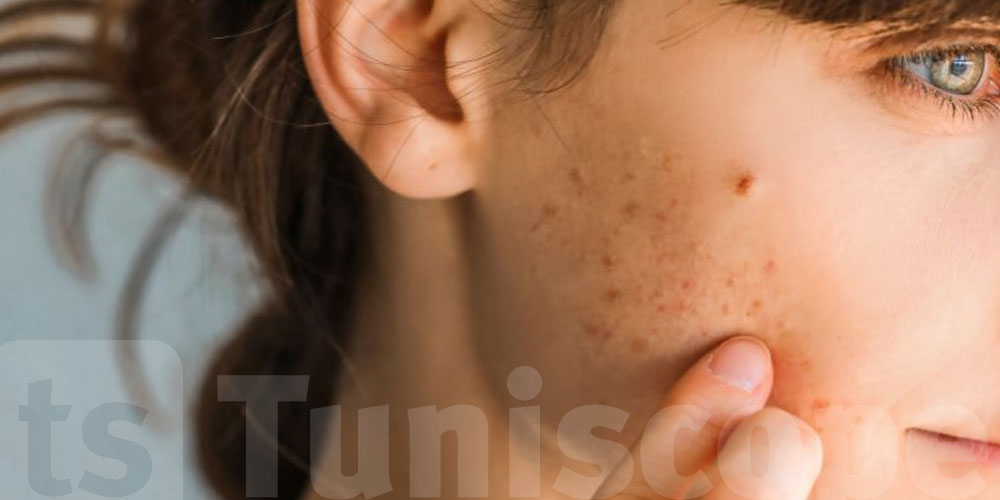 فيتامين باهي برشا يؤثر على بنية البشرة وتجديدها