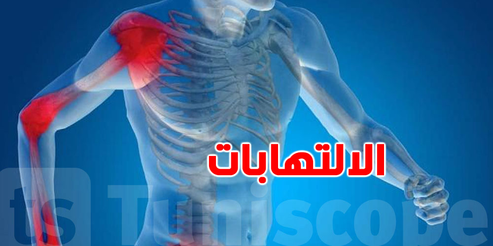 يهمّك تعرف: أنواع الالتهابات...الأسباب والأعراض اللي متاعها