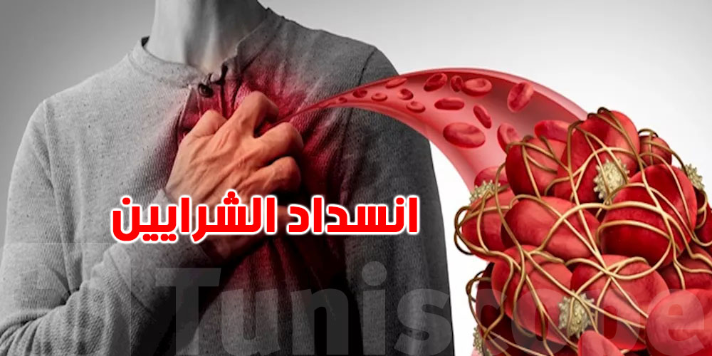 علامات ليلية خطيرة قد تكشف انسداد الشرايين… لا تتجاهلها