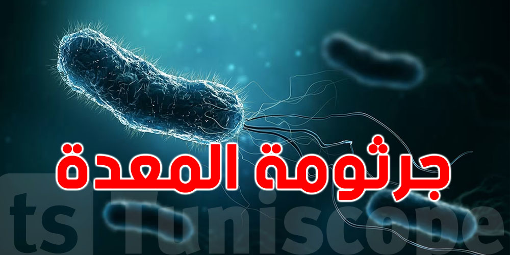 فُمك يكشف إصابتك بجرثومة المعدة