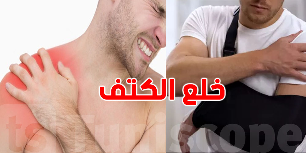  كيفاش ترقد بعد خلع الكتف بلاش وجيعة؟