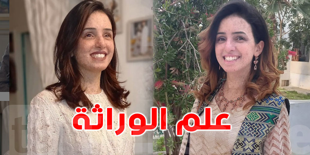 لتفهم مرضها: فتاة القمر لمياء تحصل على الدكتوراه في علم الوراثة