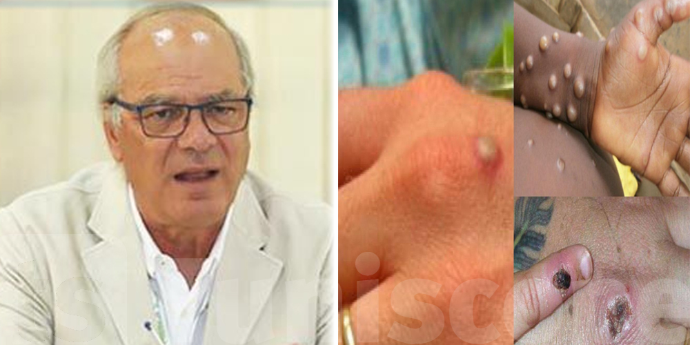 Tunisie-coronavirus : Les personnes concernées par une 3ème dose