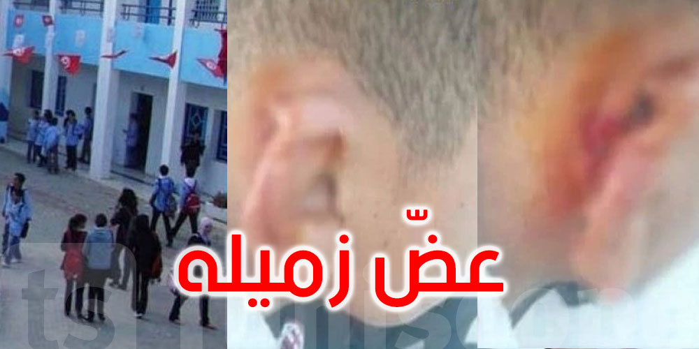 تونس.. تلميذ يعضّ أذن زميله ويقطع جزء منها
