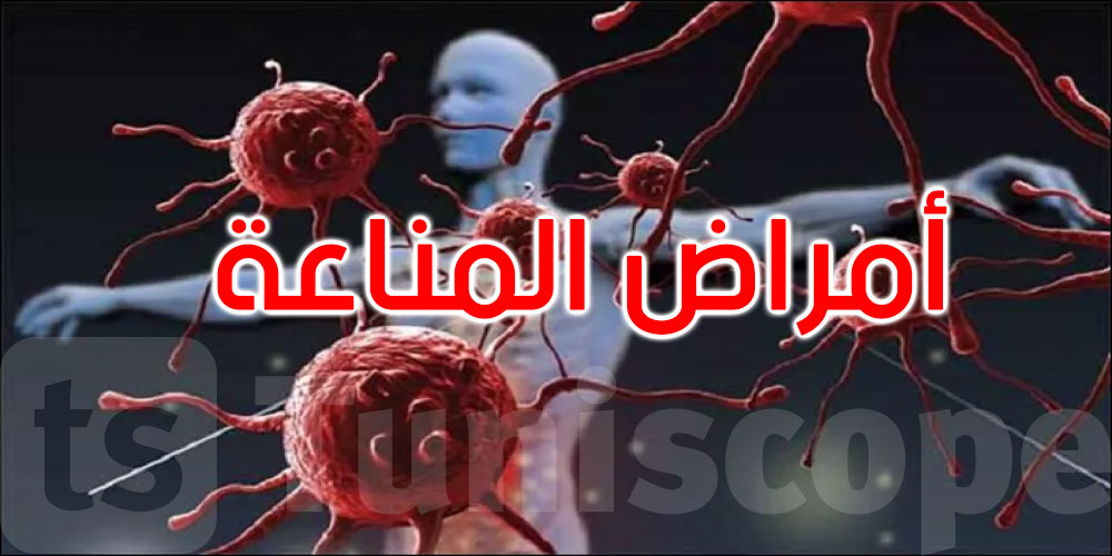 ‘معجزة طبية’: علاج واحد يشفي امرأة من 3 أمراض مناعية ذاتية