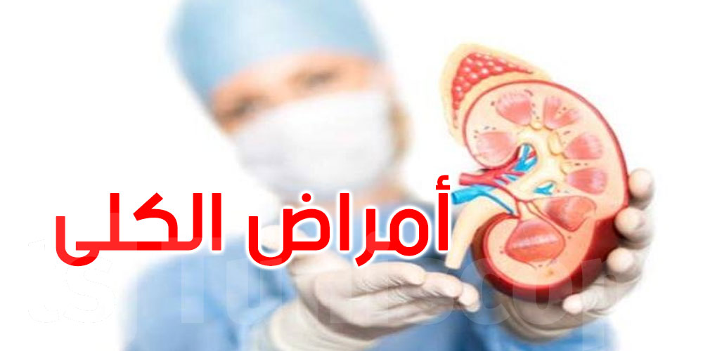 وزارة الصحة: أمراض الكلى أصبحت من أبرز تحديات الصحة العمومية