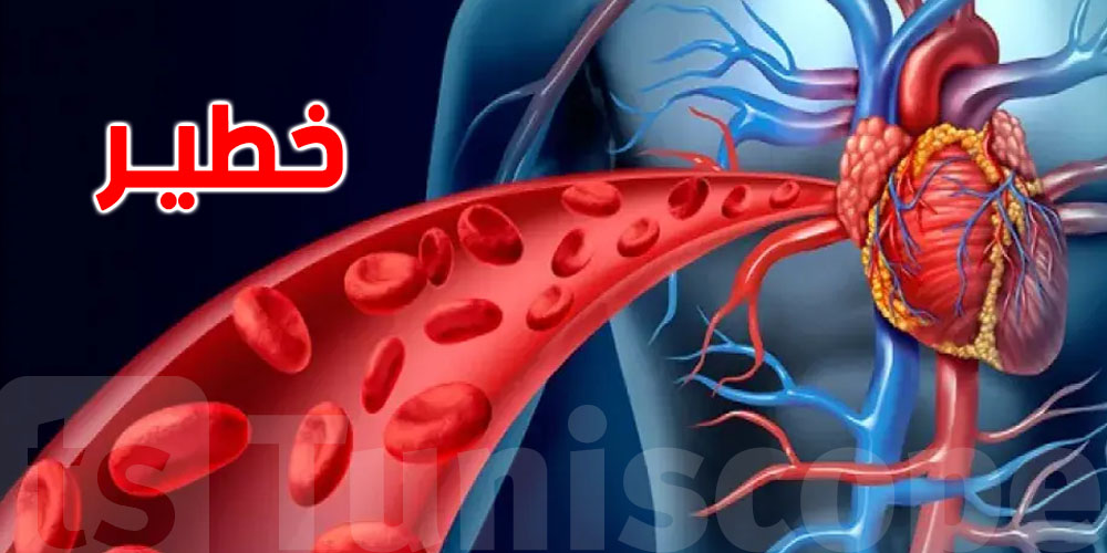  سرّ يبطئ تصلب الشرايين ويقلل خطر السرطان