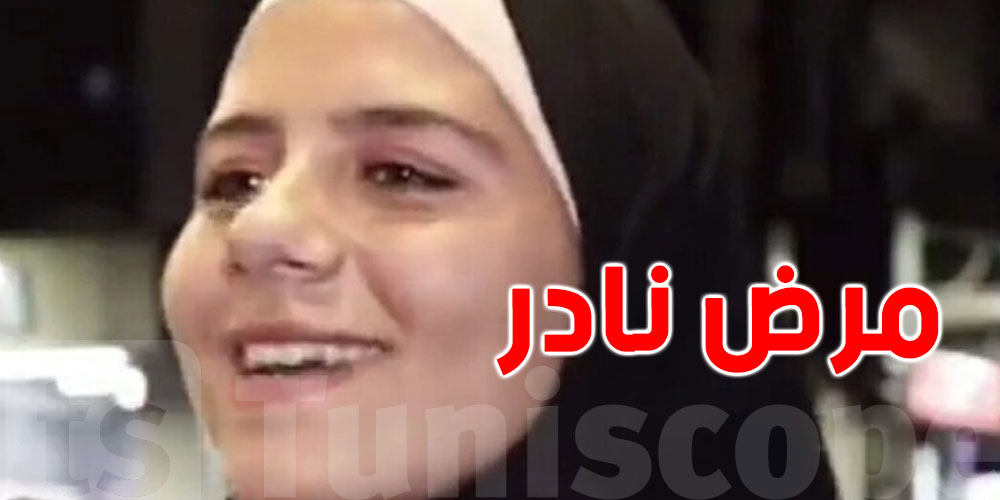 مرض نادر يجبر شابة سورية على الضحك حتى الإغماء