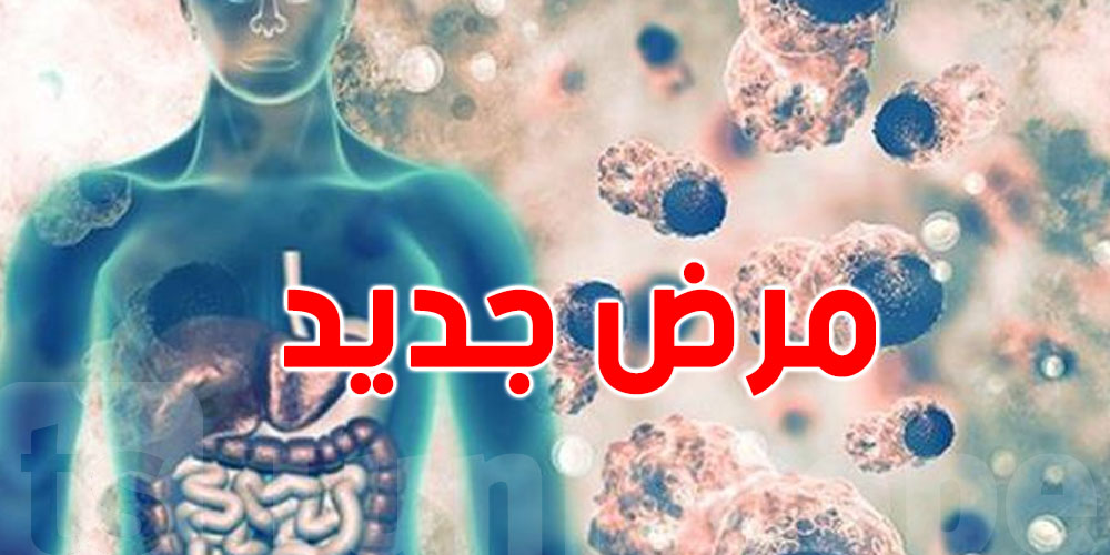 الولايات المتحدة تعلن عن تفشي داء قاتل