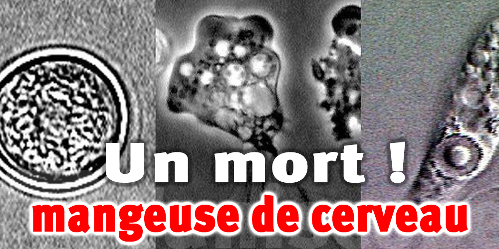 Premier décès dû à l'’’amibe mangeuse de cerveau’’ en…