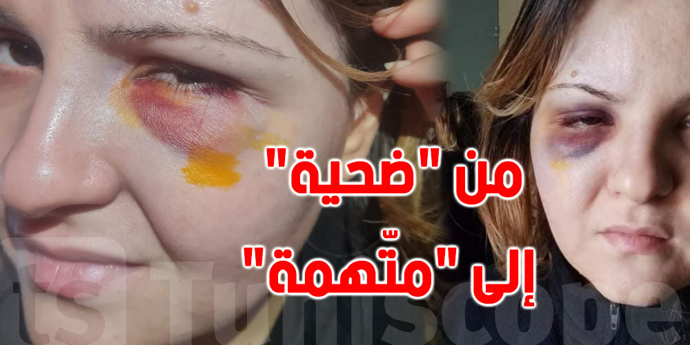صور صادمة: مواطنة تونسية تتعرّض لاعتداء قاتل وتتحوّل إلى ''متّهمة''