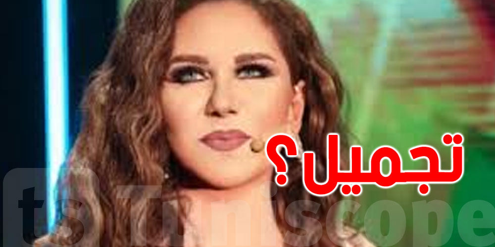 هل أجرت ''ميادة الحناوي'' عملية تجميل؟