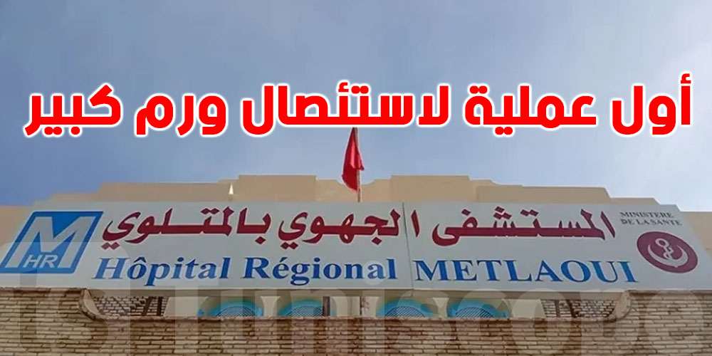 نجاح أول عملية دقيقة لاستئصال ورم كبير في رحم مريضة بالمتلوي