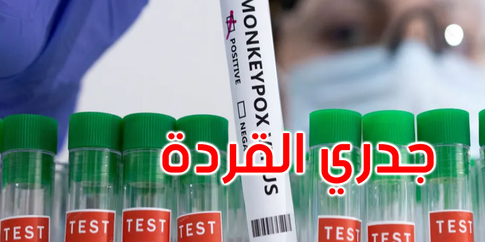 جدري القردة: تطور خطير وتسجيل وفيات في دول إفريقية