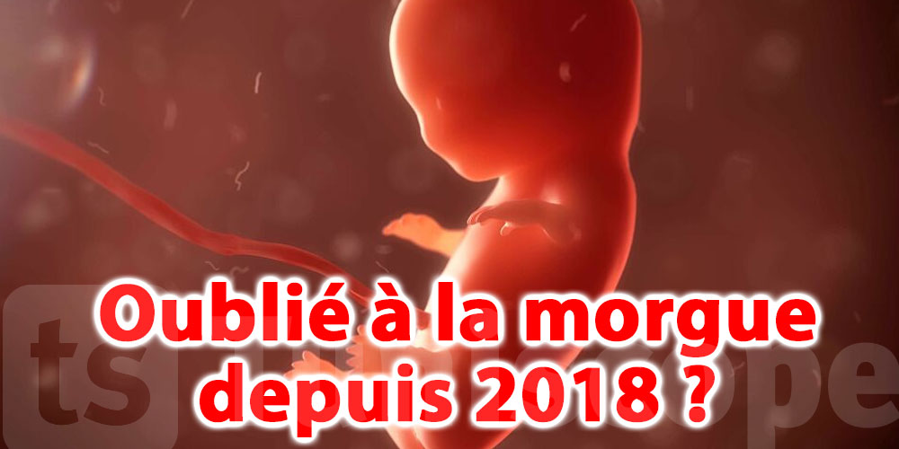 Tunisie: Un fœtus oublié à la morgue depuis 2018 ? le vrai du faux 