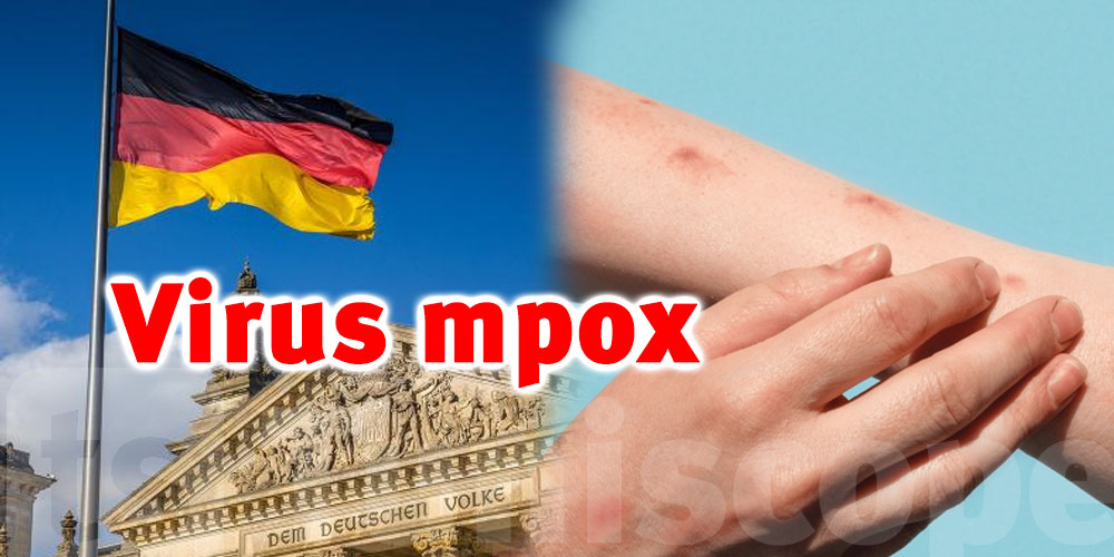 Mpox : une nouvelle souche identifiée pour la première fois à Berlin