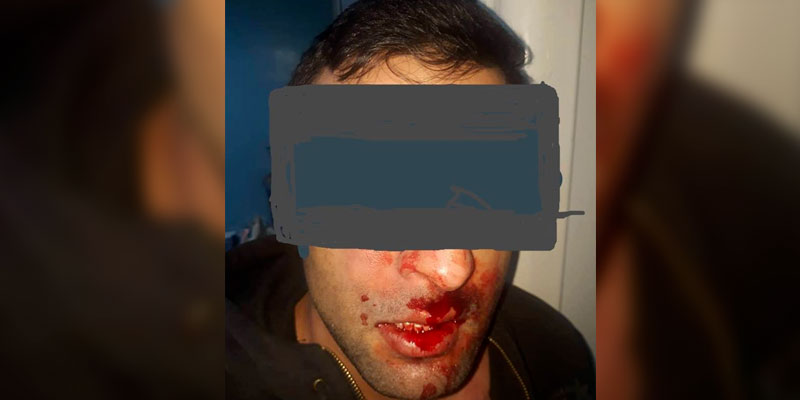 Un interne violemment agressé à l’hôpital de Ben Arous 