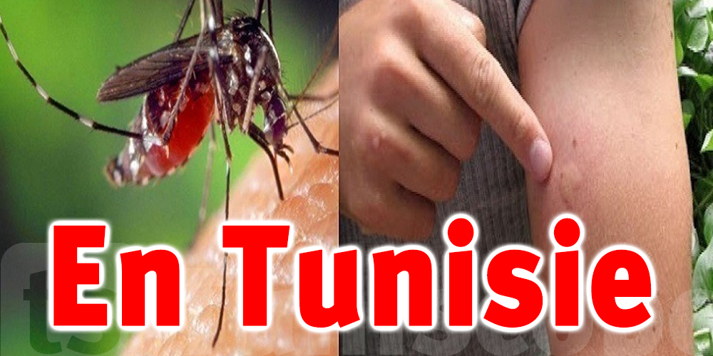 Virus du Nil occidental en Tunisie, les symptômes