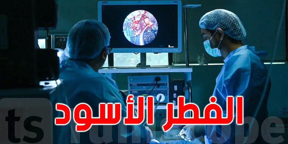 خطير..ثاني وفاة بـ''الفطر الأسود''