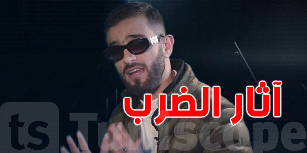 النوردو: ''مازلت نعاني من آثار الضرب في الفوندو''