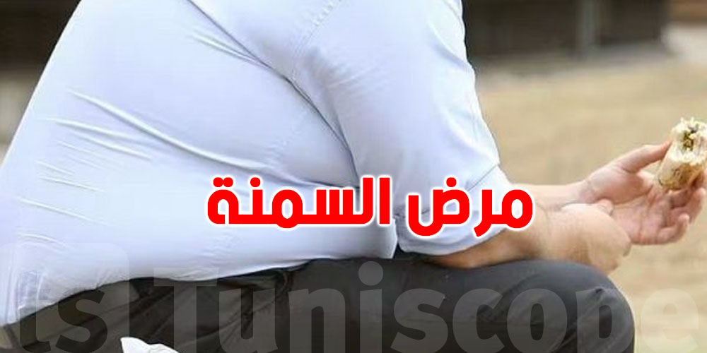 تزايد مرض السمنة في تونس