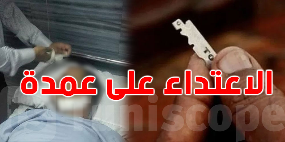 سوسة.. ترصّدوا العمدة وفتحوا وجهه بشفرة حلاقة