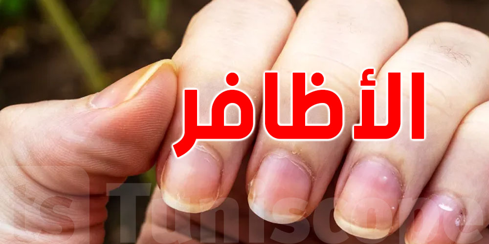 فطريات الأظافر: كيفاش تتشخّص وتتعالج قبل ما تكبر المشكلة؟