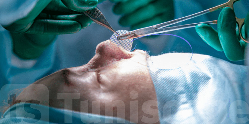 Des spécialistes alertent : la chirurgie esthétique va bien au-delà de l’apparence