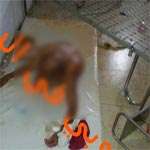 Photos choquantes d’un patient à l’hôpital de Jendouba : le directeur de l’hôpital explique 