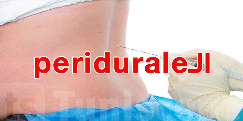 الـ péridurale باهية وإلا خايبة؟