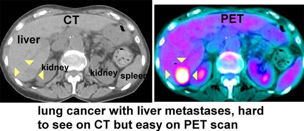« Pet Scan », nouvelle technique de diagnostic précoce de la maladie cancéreuse, en Tunisie