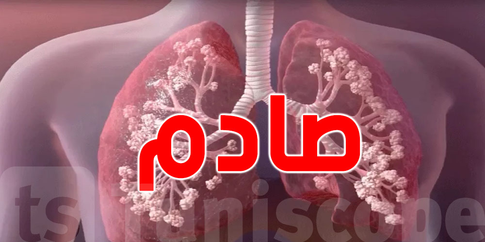 مرض صامت يُدمّر الرئة: تونس تسجّل 150 إصابة جديدة كل عام!