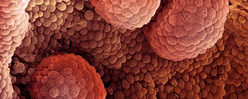 prostate-18042012-1.jpg