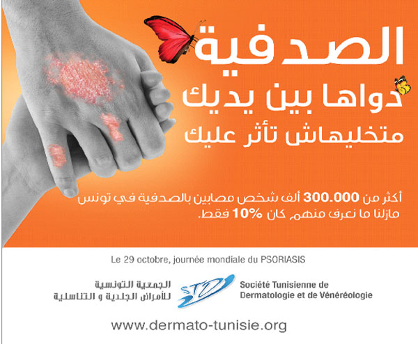 psoriasis-171015-4.jpg