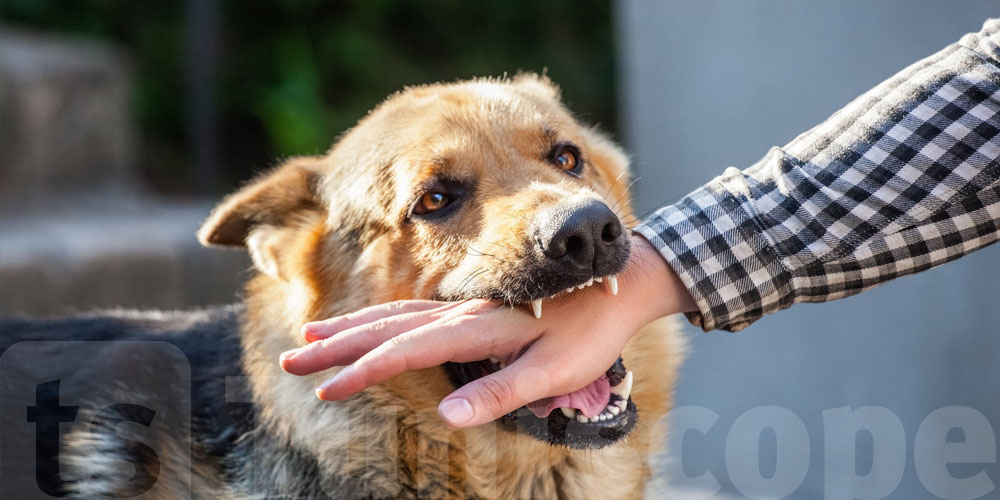 Comment réagir en cas de morsure de chien ?