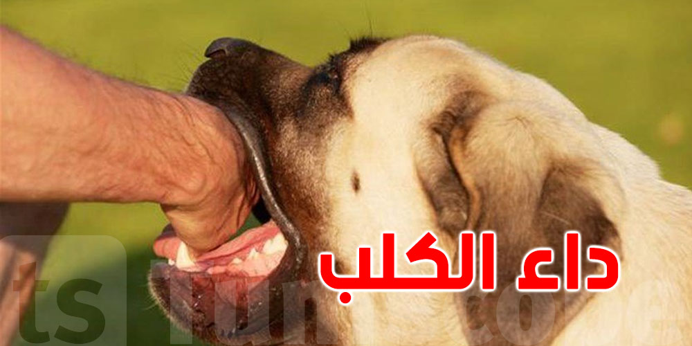 عاجل : تونس تسجل 4 وفيات بداء الكلب