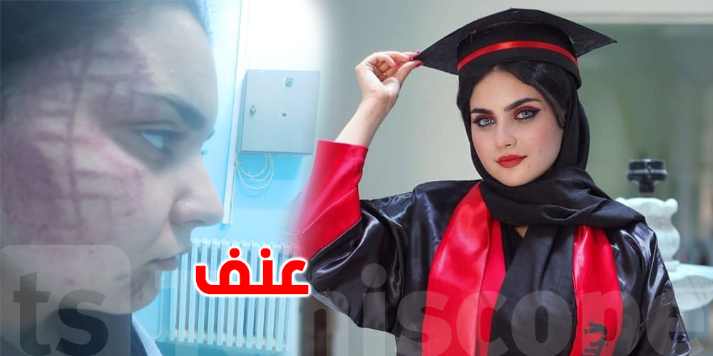 بالصورة، عندما يكون ''الأخ'' نقمة وليس نعمة..التونسية رحاب فرج تروي قصّتها
