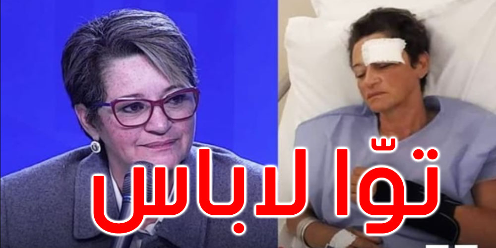 ريم الزريبي تتحدث عن حادث المرور الذي تعرضت له