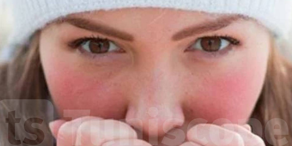 رد بالك ...عادة يومية تؤذي بشرتك