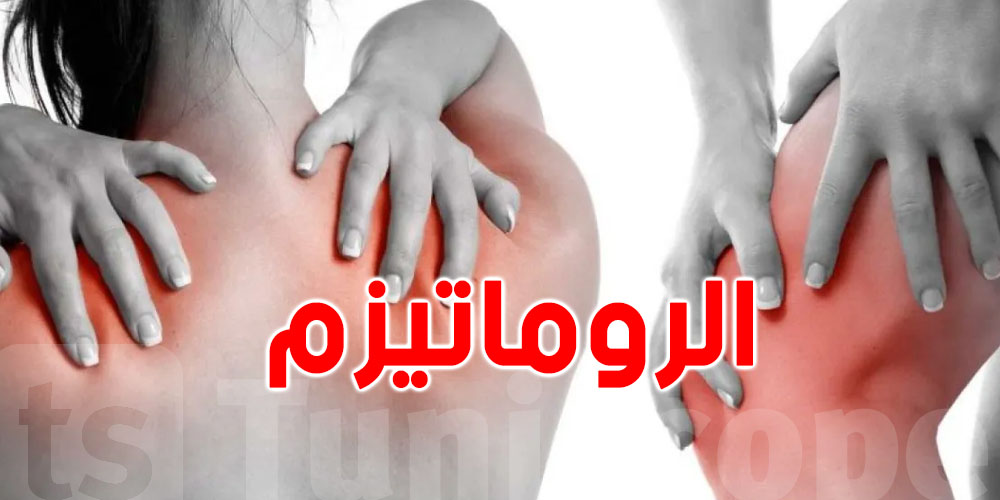  مرض ''الروماتيزم'' أعراضه و كيفية الوقاية