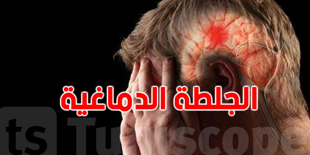 كيف يمكن إنقاذ مريض بأعراض الجلطة الدماغية من الموت ؟