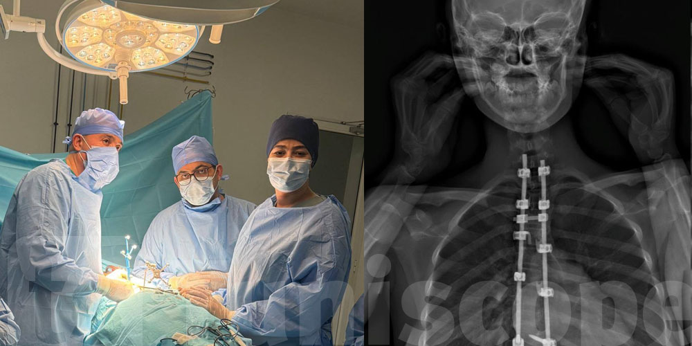 عاجل  : أول عملية اعوجاج العمود الفقري للأطفال بنجاح كامل في سبيطار القصاب ...تفاصيل