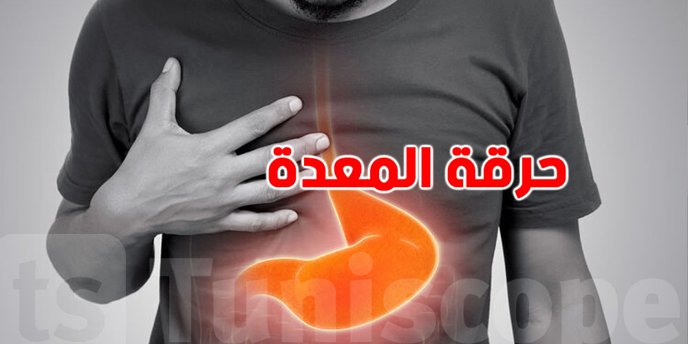 حرقة المعدة في رمضان...شنوّة أسبابها؟