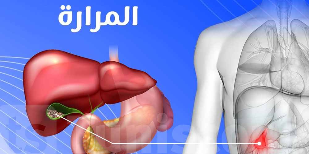 المرارة: المرض اللي ينجم يولي خطير برشة