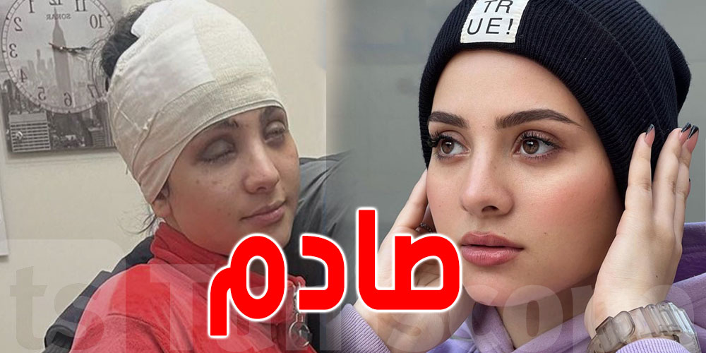 فظيع: سارة محمد تفقد بصرها في ''براكاج''