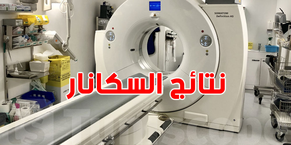 نداء عاجل: سكانار في مستشفى بالعاصمة يتأخر حتى لـ15 يوم!