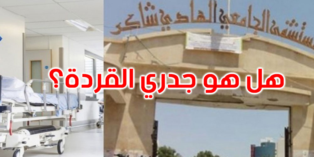 صفاقس: هذه حقيقة إصابة مريضة مقيمة بالمستشفى بجدري القردة